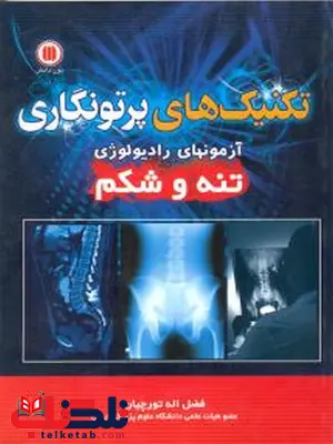 تکنیک های پرتونگاری آزمونهای رادیولوژی تنه و شکم تورچیان تکنیک های پرتونگاری آزمونهای رادیولوژی تنه و شکم تورچیان