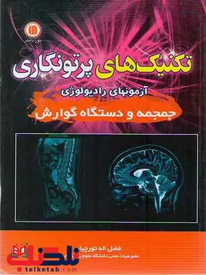 تکنیک های پرتونگاری آزمونهای رادیولوژی جمجمه و دستگاه گوارش تورچیان تکنیک های پرتونگاری آزمونهای رادیولوژی جمجمه و دستگاه گوارش تورچیان