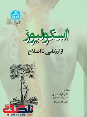 اسکولیوز از ارزیابی تا اصلاح نویسنده فواد صیدی و علی کشتی آرای اسکولیوز از ارزیابی تا اصلاح نویسنده فواد صیدی و علی کشتی آرای